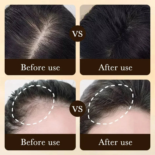 Biotin Hair Growth Oil Treatment – Scalp Massage & Repair