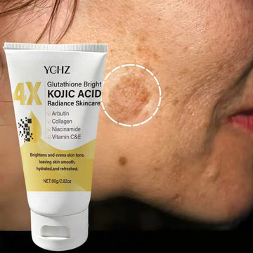 Kojic Acid Dark Spot Face Cream – Whitening & Evening Cream