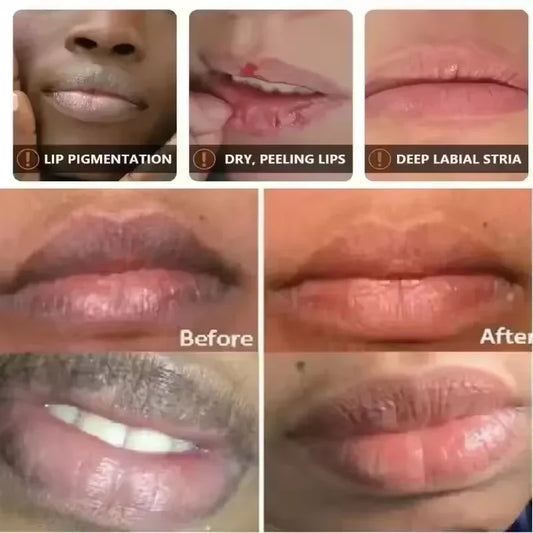 Lip Mask Serum – Lightening Dark Lip Balm & Exfoliating Treatment