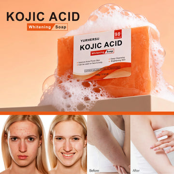 Kojic Acid Brightening Facial Cleanser Bar – Natural Soap