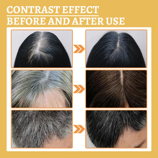 Black Ganoderma Hair Strengthening Liquid – Reduce Hair Loss, Nourish Roots