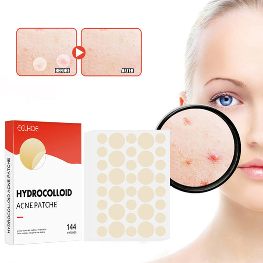 Invisible Acne Pimple Patches 144pc – Professional Spot Healing