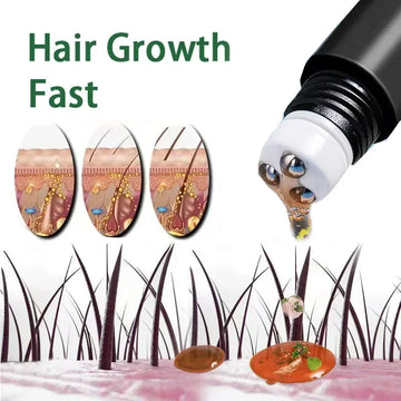 Biotin Hair Growth Oil Treatment – Scalp Massage & Repair